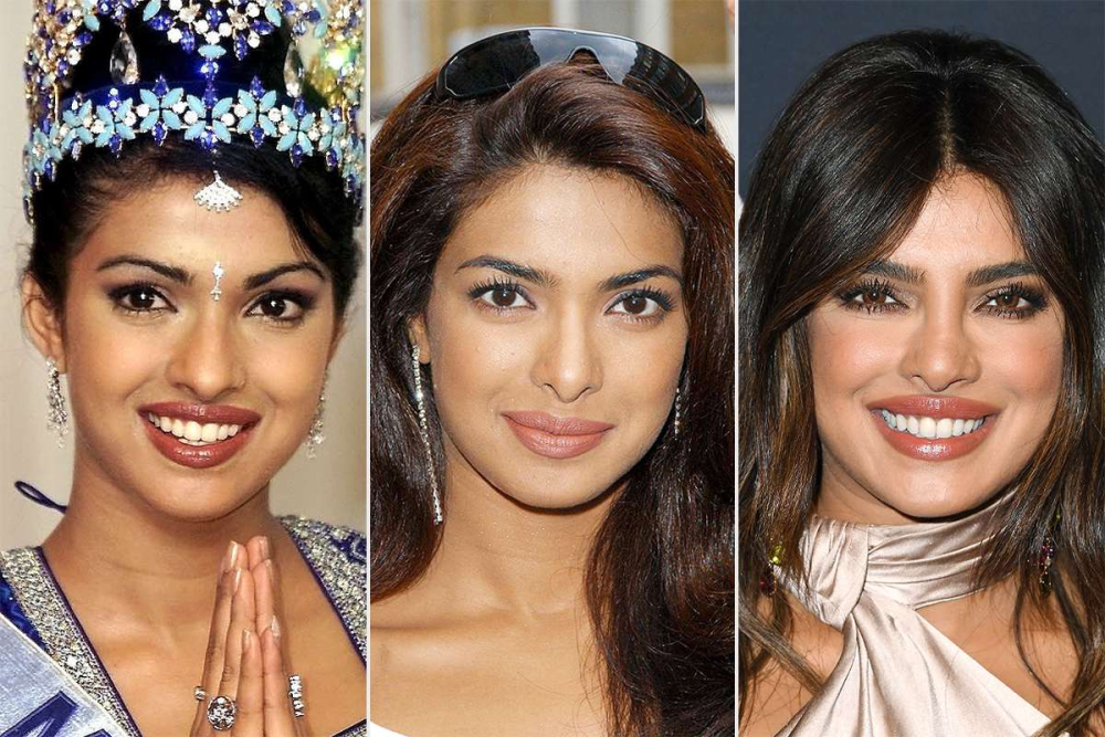 Priyanka Chopra Talks About Depression After Botched Nose Surgery Masala 5707