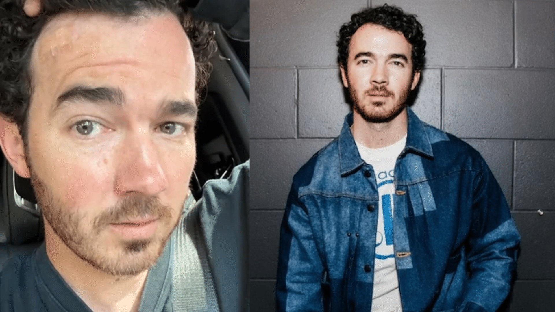 Kevin Jonas Diagnosed With Skin Cancer? Here’s The Whole Truth!